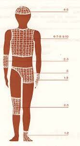 Bandage Samilast no 2  ( Doigts - Poignet )