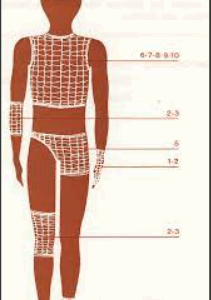 Bandage Samilast no 8  ( Poitrine - Abdomen - Aisselle )